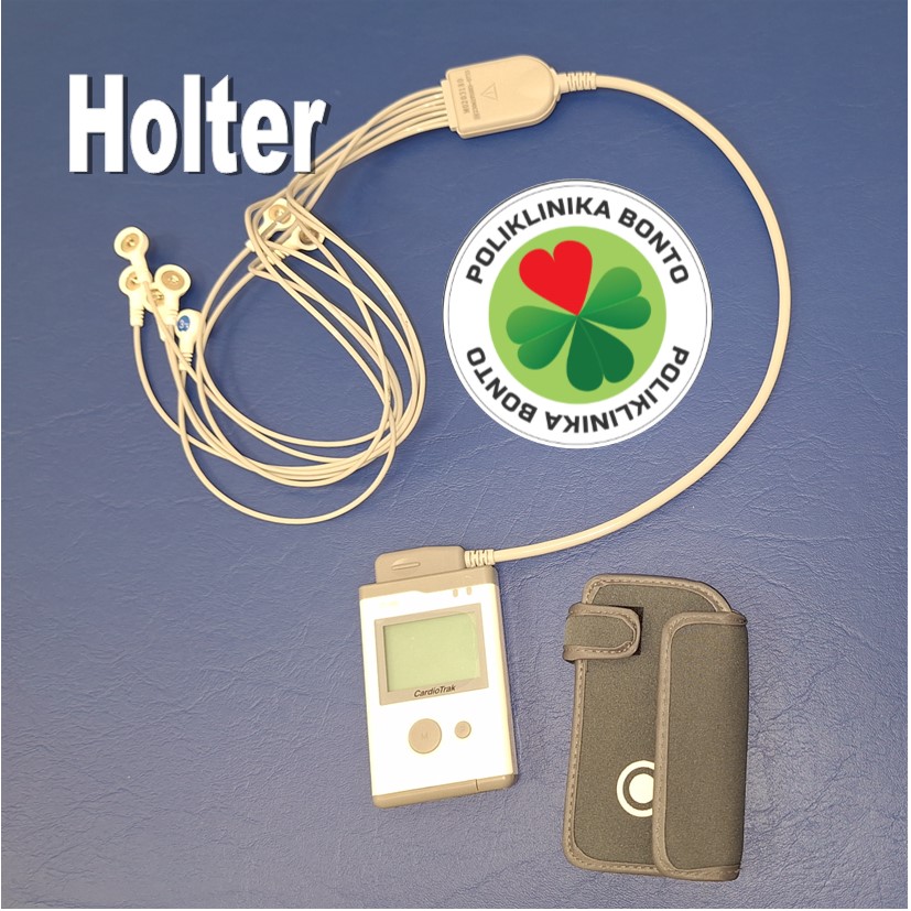 Holter EKG 24 do 72 sata Zagreb